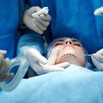 عملکرد بیمه‌گران در پوشش جراحی‌های زیبایی نیازمند بازنگری